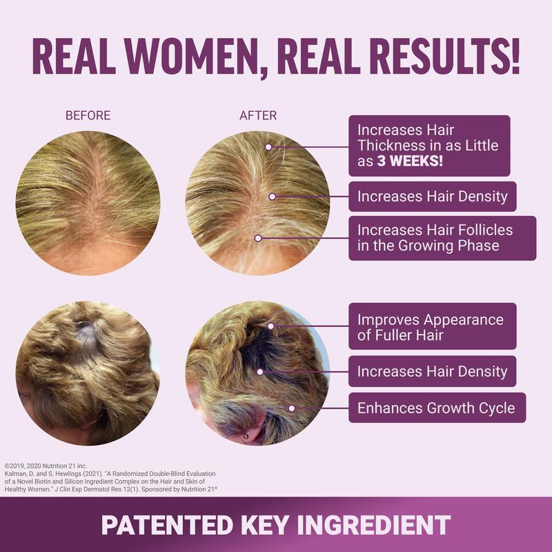 Hair Growth Accelerator Soft Chews