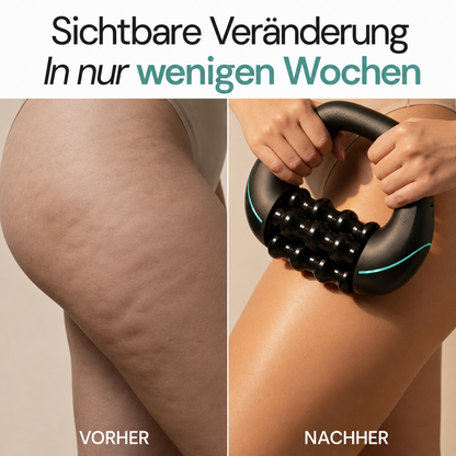 Sireli™ RollShaper | Für glattere, straffere Haut