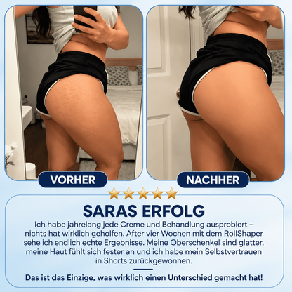 Sireli™ RollShaper | Für glattere, straffere Haut