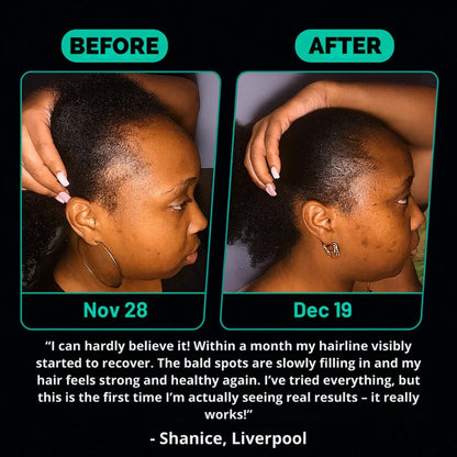 Batana Oil – Naturally Stronger, Shinier, Thicker Hair