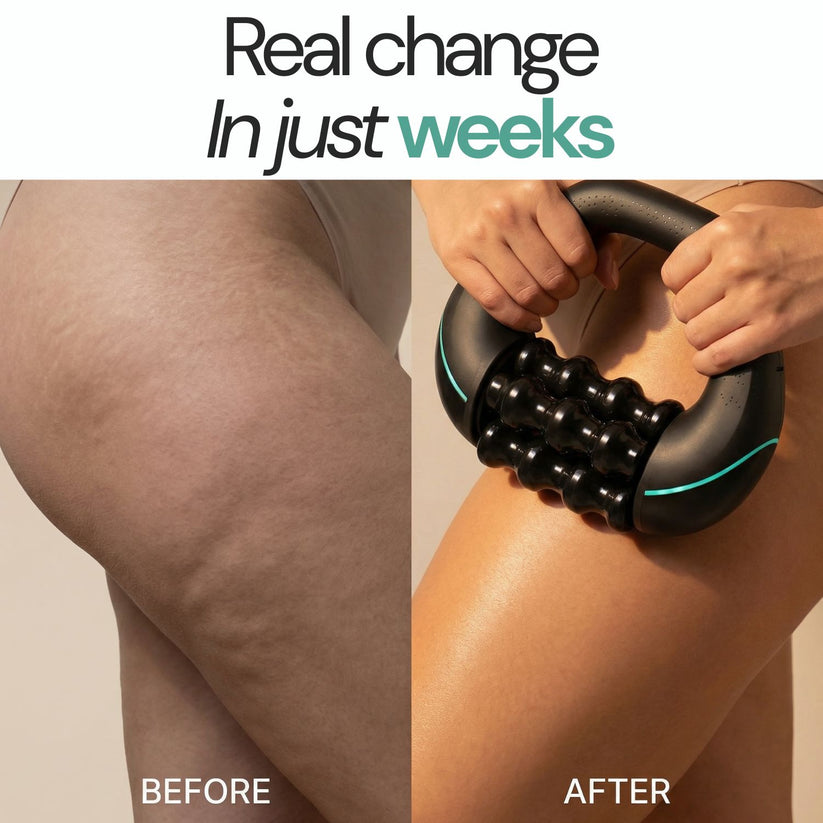 Rollshaper | Smoother, firmer skin
