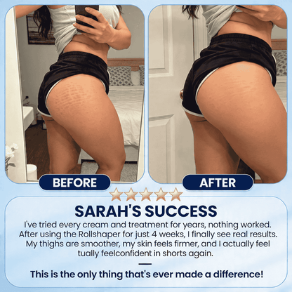 Rollshaper | Smoother, firmer skin