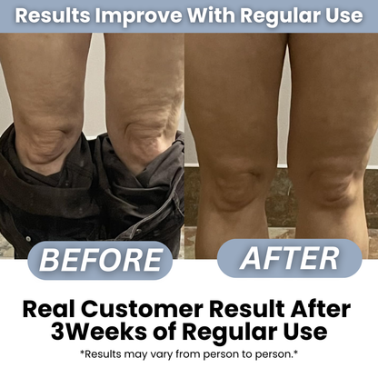 Anti Cellulite Roller + Massage Oil Kit